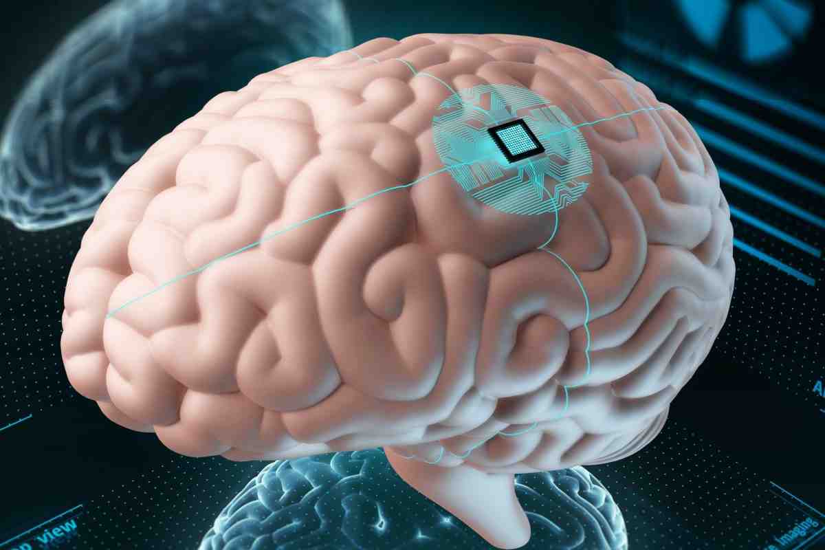 Hjerneimplantater: Veien til en ny æra av teknologi og menneskelig potensial Hjerneimplantater er i ferd med å revolusjonere måten vi tenker på samspillet mellom menneske og maskin. Teknologien, som kobler hjernen direkte til datamaskiner, lover å endre alt fra medisinsk behandling til hvordan vi lærer og kommuniserer. Flere selskaper jobber nå med å utvikle såkalte hjerne-datamaskin-grensesnitt, og konkurransen øker. Her ser vi nærmere på hva hjerneimplantater er, hvilke muligheter de gir, og hvilke utfordringer som ligger foran oss. Hva gjør hjerneimplantater unike? Hjerneimplantater er små enheter som settes inn i hjernen for å registrere eller stimulere hjerneaktivitet. De fungerer som en bro mellom nevrale signaler og digitale systemer, og oversetter tanker til kommandoer en datamaskin kan forstå. For eksempel kan en person med lammelser bruke et implantat til å styre en robotarm eller skrive på en skjerm uten å bruke hendene. Teknologien bygger på avanserte elektroder og AI for å tolke komplekse signaler fra hjernen. Dette feltet er fortsatt ungt, men potensialet er enormt. Nye aktører i feltet Et selskap som satser stort på hjerneimplantater, er Merge Labs, støttet av OpenAI. Målet er å utvikle grensesnitt som bruker kunstig intelligens til å gjøre samspillet mellom hjerne og maskin mer intuitivt. OpenAI, som er kjent for sine språkmodeller, ser for seg en fremtid der AI kan tolke tanker direkte, uten behov for tastatur eller skjerm. Merge Labs planlegger å samle inn betydelige midler for å realisere denne visjonen, og fokuserer på å skape teknologi som er både kraftig og tilgjengelig. Sammenligning med etablerte pionerer Neuralink, grunnlagt av Elon Musk, er en av lederne i dette feltet. Deres implantater har allerede vist lovende resultater, som å la en person med lammelser styre en datamaskin eller spille spill kun ved hjelp av tankene. Neuralink har ambisjoner om å skalere teknologien til tusenvis av brukere i nær fremtid. Merge Labs, med støtte fra OpenAI, ønsker å utfordre dette forspranget ved å kombinere hjerneimplantater med avansert AI, noe som kan gi mer sømløse og intelligente interaksjoner. Hva kan hjerneimplantater brukes til? Mulighetene med hjerneimplantater er mangfoldige. For personer med nevrologiske skader, som ved ryggmargsskader eller ALS, kan teknologien gi ny frihet ved å erstatte tapte funksjoner. Utenfor medisinske bruksområder kan implantater potensielt forsterke kognitive evner, som å forbedre hukommelse eller læringshastighet. Noen eksperter ser for seg en fremtid der vi integrerer AI så tett med hjernen at vi får tilgang til informasjon i sanntid, som en slags «mental Google». Slike ideer høres ut som science fiction, men de blir stadig mer realistiske. Teknologiske og etiske hindre Å utvikle hjerneimplantater er ikke uten utfordringer. Teknisk sett må implantatene være små, presise og trygge for å unngå skade på hjernen. De må også kunne fungere over lang tid uten å miste effektivitet. Etiske spørsmål er like viktige: Hvem får tilgang til denne teknologien? Kan private tanker bli kompromittert? Og hva skjer hvis implantater brukes til å forsterke evner bare for de som har råd? Disse spørsmålene krever nøye diskusjon for å sikre at teknologien brukes til alles beste. En fremtid i endring Hjerneimplantater representerer et sprang mot en fremtid der teknologi og menneskelig bevissthet smelter sammen. Konkurransen mellom selskaper som Merge Labs og Neuralink driver frem innovasjon, og resultatene kan endre liv – fra å hjelpe mennesker med funksjonsnedsettelser til å utforske nye måter å tenke på. Selv om teknologien fortsatt er i startfasen, viser dagens fremskritt at vi er på vei mot en ny æra der grensen mellom menneske og maskin blir mindre tydelig.